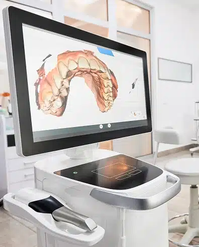 Dental scanning technology displays 3D tooth model on monitor in modern dental office.