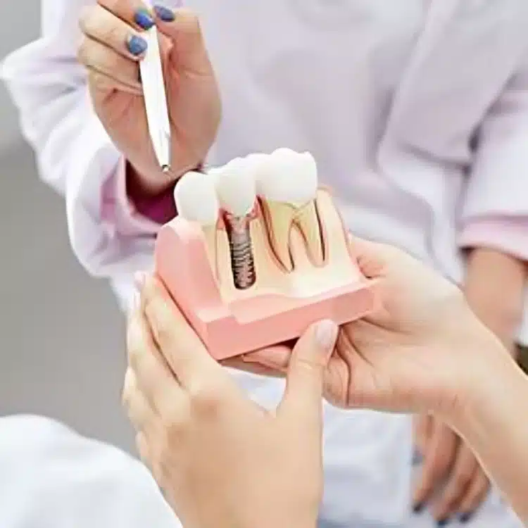 Dental professional demonstrating dental implant models to patient in clinical setting.