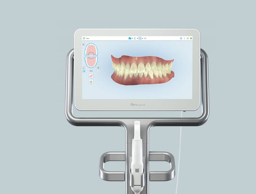 Digital dental scanner displaying 3D teeth visualization on monitor in clinical setting.